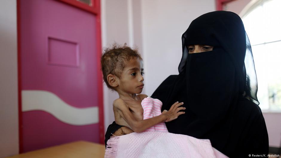 Hungersnot im Jemen immer schlimmer | DW | 11.12.2018
