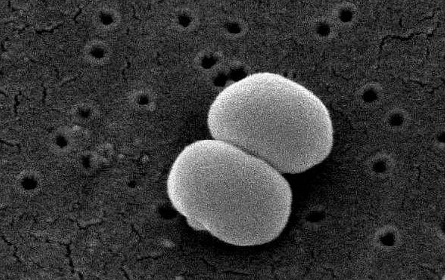 Staphylococcus epidermidis. Bild: Janice Carr/CDC