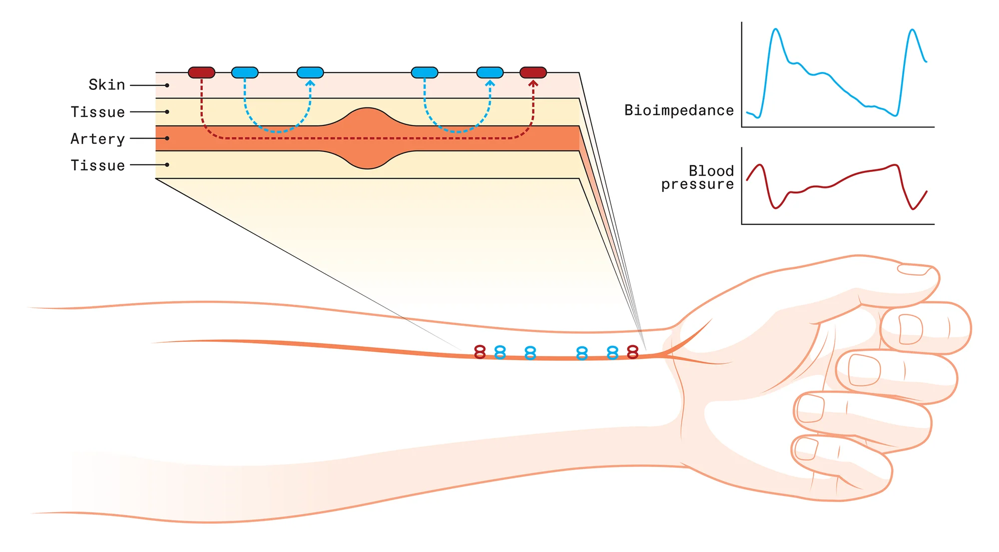 Graphene electronic tattoos (GETs) can be used for continuous blood pressure monitoring.