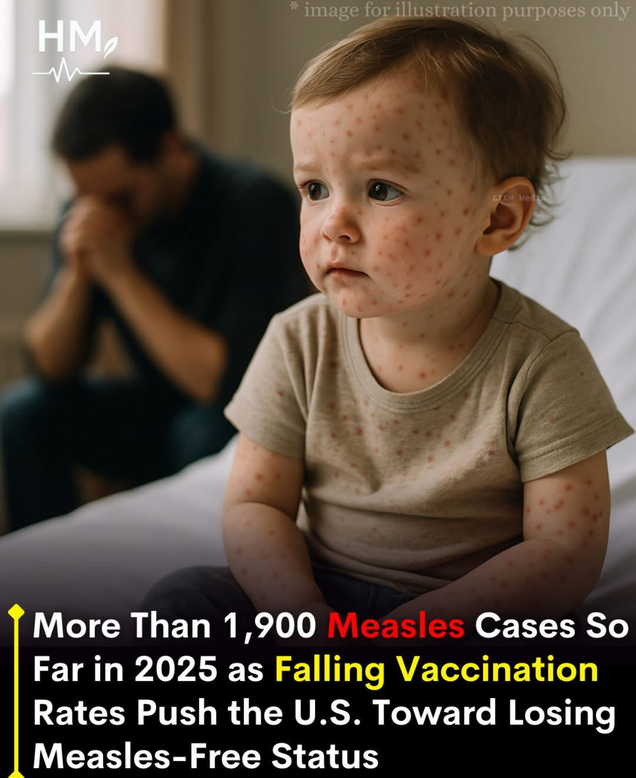 Sogar das T-Shirt hat die Masern