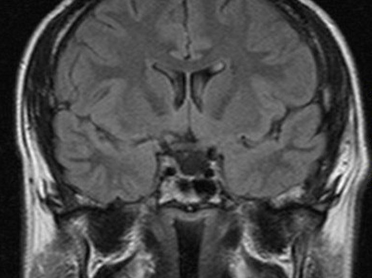 Wenn KI das Denken übernimmt und die Gehirne befreit