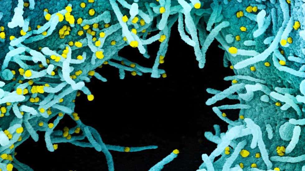 WHO plant Erreger-Börse - „Das Problem ist mangelnde Transparenz, wo astronomische Gewinne locken“