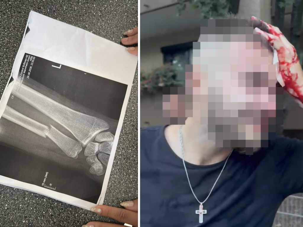 „Erzieherische Abreibung“: 40 Antifa-Schläger prügeln konservative Aktivisten mit Schlagstöcken krankenhausreif - Apollo News